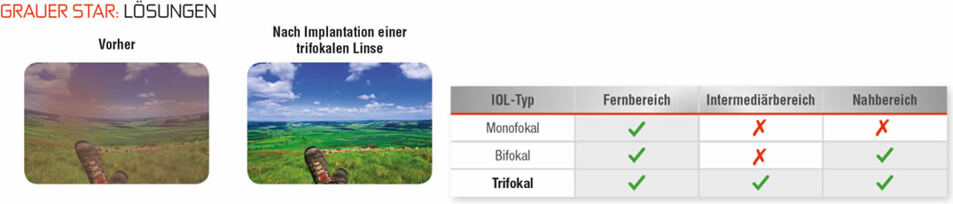 Grauer Star: Lösungen